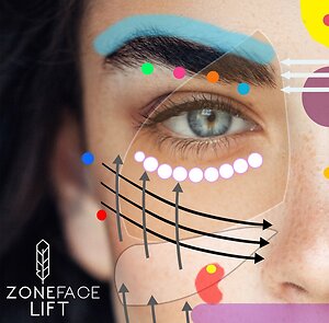 Zone Face Lift. ZFLpic